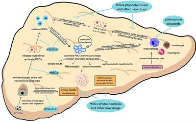 The research progress of anti-inflammatory and anti-fibrosis treatment of chronic pancreatitis